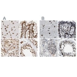 Invitrogen NIPA Polyclonal Antibody 100 &mu;L; Unconjugated:Antibodies,