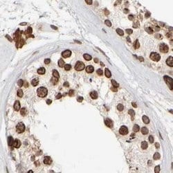 Invitrogen NIPA Polyclonal Antibody 100 &mu;L; Unconjugated:Antibodies,