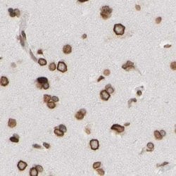 Invitrogen NIPA Polyclonal Antibody 100 &mu;L; Unconjugated:Antibodies,