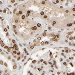 Invitrogen NIPA Polyclonal Antibody 100 &mu;L; Unconjugated:Antibodies,