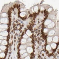 Invitrogen NIPA Polyclonal Antibody 100 &mu;L; Unconjugated:Antibodies,