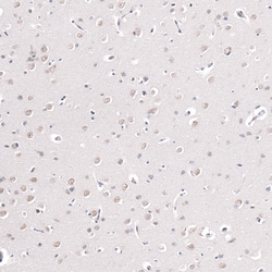 Invitrogen CAAP1 Polyclonal Antibody 100 &mu;L; Unconjugated:Antibodies,