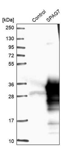 SPAG7 Polyclonal Antibody:Antibodies, Polyclonal