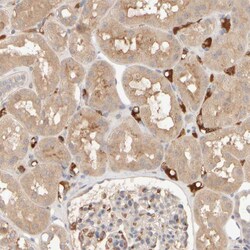 Invitrogen MSP Polyclonal Antibody 100 &mu;L; Unconjugated:Antibodies,