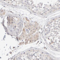 Invitrogen MSP Polyclonal Antibody 100 &mu;L; Unconjugated:Antibodies,