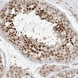 Invitrogen ZFP91 Polyclonal Antibody 100 &mu;L; Unconjugated:Antibodies,