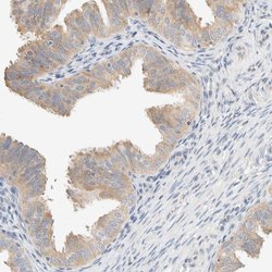 Invitrogen SUMF2 Polyclonal Antibody 100 &mu;L | Buy Online | Invitrogen&trade; | Fisher Scientific