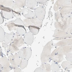 Invitrogen SUMF2 Polyclonal Antibody 100 &mu;L | Buy Online | Invitrogen&trade; | Fisher Scientific