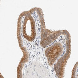 Invitrogen SUMF2 Polyclonal Antibody 100 &mu;L | Buy Online | Invitrogen&trade; | Fisher Scientific