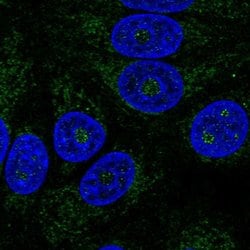 Invitrogen ABHDB Polyclonal Antibody 100 &mu;L; Unconjugated:Antibodies,