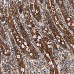 Invitrogen ABHDB Polyclonal Antibody 100 &mu;L; Unconjugated:Antibodies,