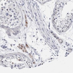 Invitrogen CATSPERD Polyclonal Antibody 100 &mu;L; Unconjugated:Antibodies,