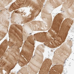 Invitrogen LMCD1 Polyclonal Antibody 100 &mu;L; Unconjugated:Antibodies,