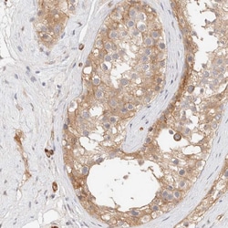 Invitrogen LMCD1 Polyclonal Antibody 100 &mu;L; Unconjugated:Antibodies,