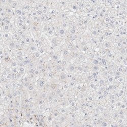 Invitrogen LMCD1 Polyclonal Antibody 100 &mu;L; Unconjugated:Antibodies,