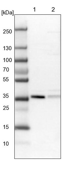 Invitrogen NDE1 Polyclonal Antibody 100 &mu;L; Unconjugated:Antibodies,