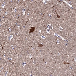 Invitrogen CEP41 Polyclonal Antibody 100 &mu;L; Unconjugated:Antibodies,