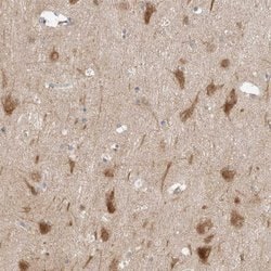 RERE Polyclonal Antibody, Invitrogen 100 &mu;L | Buy Online | Invitrogen | Fisher Scientific