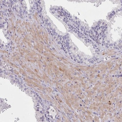 Invitrogen SETX Polyclonal Antibody 100 &mu;L | Buy Online | Invitrogen&trade; | Fisher Scientific