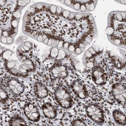 Invitrogen TOP2B Polyclonal Antibody 100 &mu;L; Unconjugated:Antibodies,