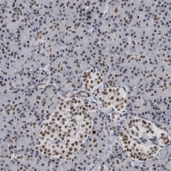 Invitrogen TOP2B Polyclonal Antibody 100 &mu;L; Unconjugated:Antibodies,