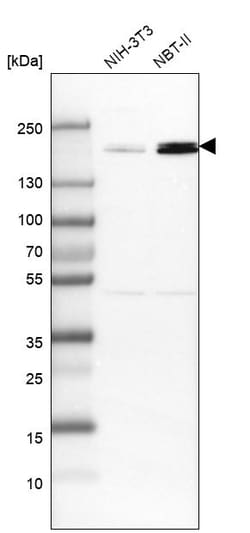 Invitrogen TOP2B Polyclonal Antibody 100 &mu;L; Unconjugated:Antibodies,