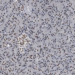 Invitrogen TOP2B Polyclonal Antibody 100 &mu;L; Unconjugated:Antibodies,