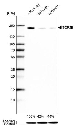 Invitrogen TOP2B Polyclonal Antibody 100 &mu;L; Unconjugated:Antibodies,