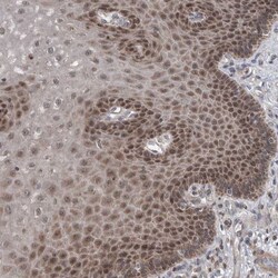 Invitrogen CWC27 Polyclonal Antibody 100 &mu;L; Unconjugated:Antibodies,
