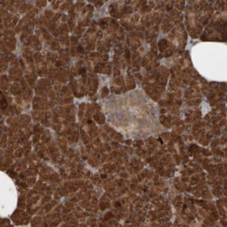 Invitrogen CCP3 Polyclonal Antibody 100 &mu;L; Unconjugated:Antibodies,