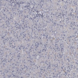 Invitrogen PPP1R12B Polyclonal Antibody 100 &mu;L; Unconjugated:Antibodies,