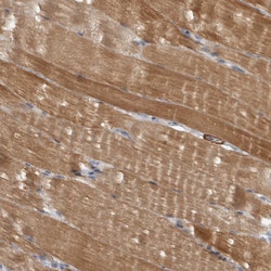 Invitrogen PPP1R12B Polyclonal Antibody 100 &mu;L; Unconjugated:Antibodies,