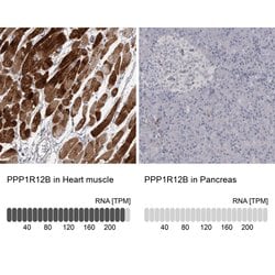 Invitrogen PPP1R12B Polyclonal Antibody 100 &mu;L; Unconjugated:Antibodies,