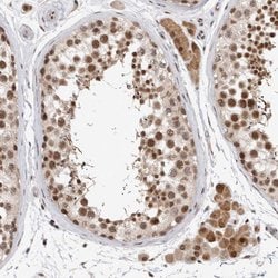 Invitrogen HESX1 Polyclonal Antibody 100 &mu;L; Unconjugated:Antibodies,
