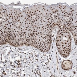 Invitrogen HESX1 Polyclonal Antibody 100 &mu;L; Unconjugated:Antibodies,