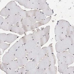 Invitrogen HESX1 Polyclonal Antibody 100 &mu;L; Unconjugated:Antibodies,
