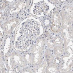 Invitrogen SERPINB7 Polyclonal Antibody 100 μL; Unconjugated:Antibodies,