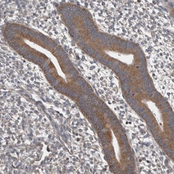Invitrogen DDX6 Polyclonal Antibody 100 &mu;L; Unconjugated:Antibodies,