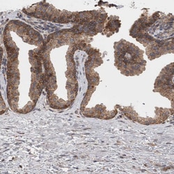Invitrogen DDX6 Polyclonal Antibody 100 &mu;L; Unconjugated:Antibodies,