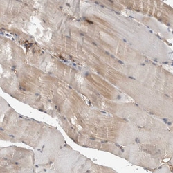 Invitrogen DDX6 Polyclonal Antibody 100 &mu;L; Unconjugated:Antibodies,