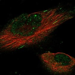 Invitrogen KIF18B Polyclonal Antibody 100 &mu;L; Unconjugated:Antibodies,
