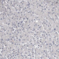 Invitrogen KIF18B Polyclonal Antibody 100 &mu;L; Unconjugated:Antibodies,
