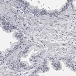 Invitrogen KIF18B Polyclonal Antibody 100 &mu;L; Unconjugated:Antibodies,