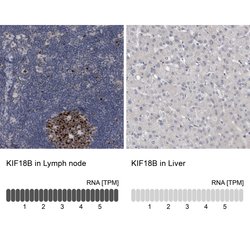 Invitrogen KIF18B Polyclonal Antibody 100 &mu;L; Unconjugated:Antibodies,