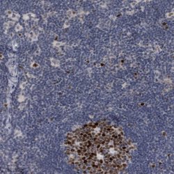 Invitrogen KIF18B Polyclonal Antibody 100 &mu;L; Unconjugated:Antibodies,