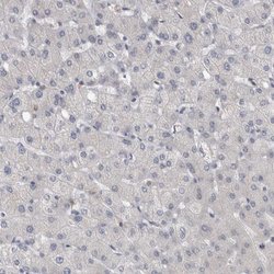 Invitrogen KIF18B Polyclonal Antibody 100 &mu;L; Unconjugated:Antibodies,