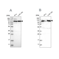 Invitrogen IARS2 Polyclonal Antibody 100 &mu;L; Unconjugated:Antibodies,