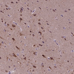 KIAA1107 Polyclonal Antibody:Antibodies, Polyclonal