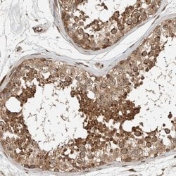 Invitrogen Synip Polyclonal Antibody 100 &mu;L; Unconjugated:Antibodies,