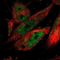 Invitrogen CPSF2 Polyclonal Antibody 100 &mu;L; Unconjugated:Antibodies,